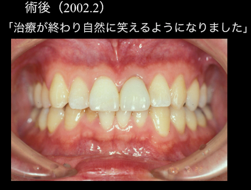 前歯部審美治療のルール - www.centroats.com.br