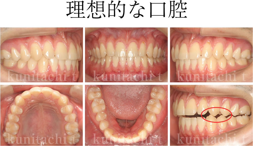 理想的な口腔