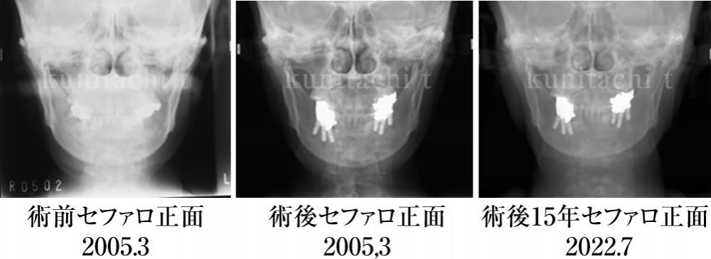 治療前後の比較