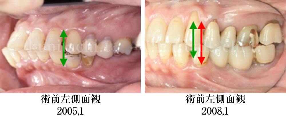 治療前後の比較