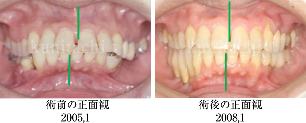 治療前後の比較