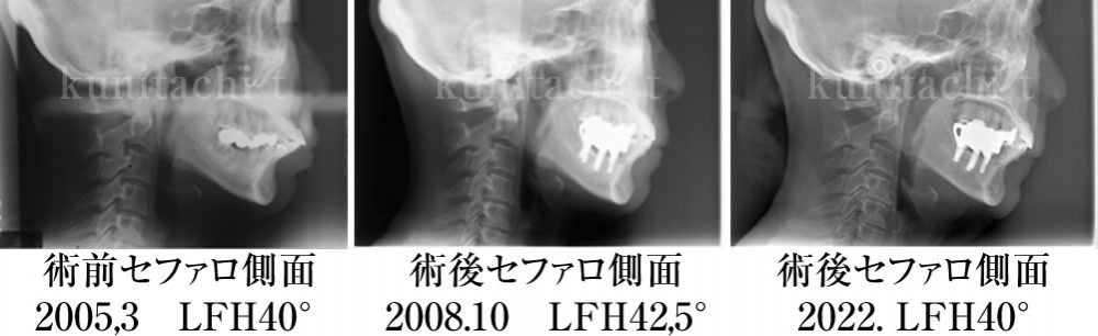 治療前後の比較