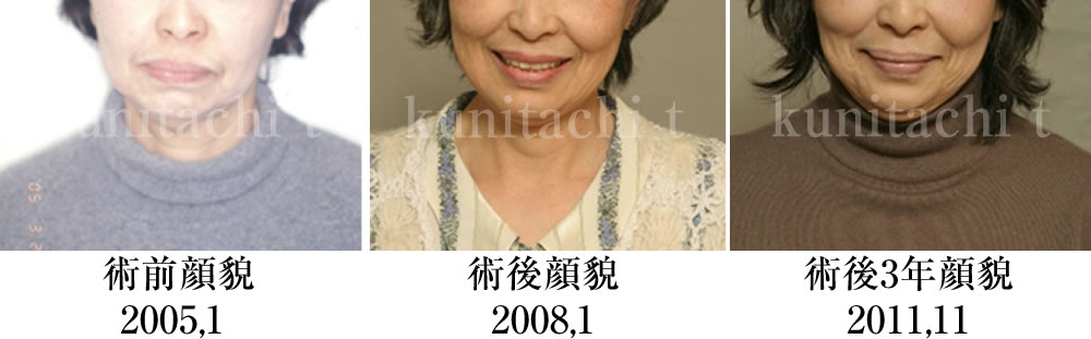 治療前後の比較