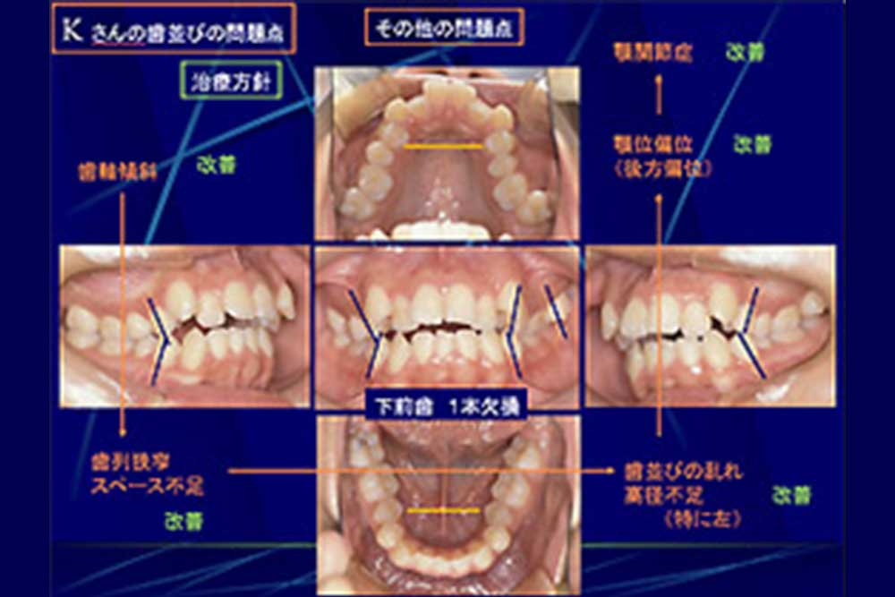 コンサルテーション